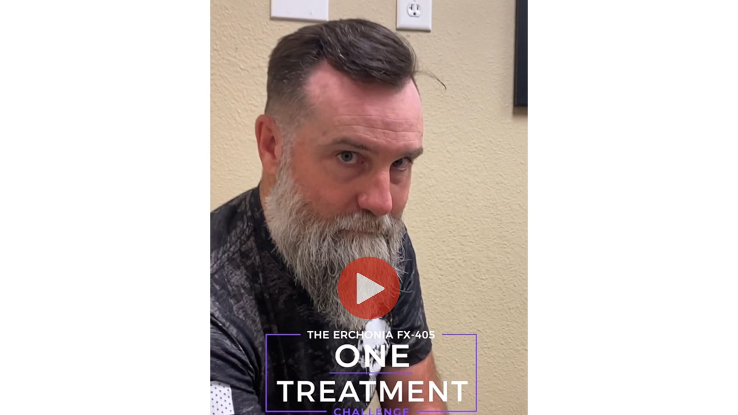 Patient Shannon before his cool laser pain treatment